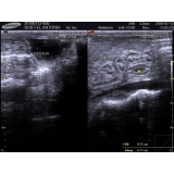 onde fazer ultrassom em animais Santa Maria onde fazer ultrassom em animais Santa Maria